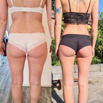 Metamorfoza - Marta - widok z tyłu