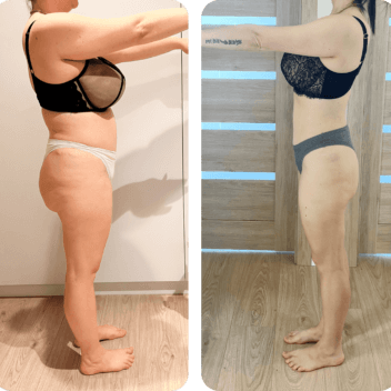 Metamorfoza - Kasia - widok z boku