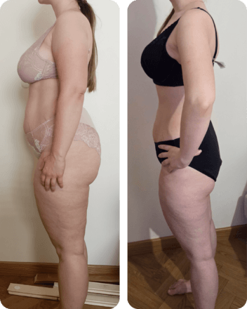 Metamorfoza - Anna - widok z boku