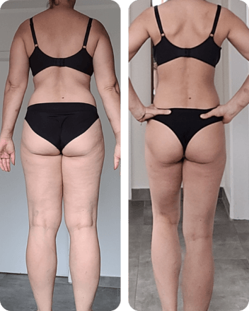 Metamorfoza - Marta - widok z tyłu